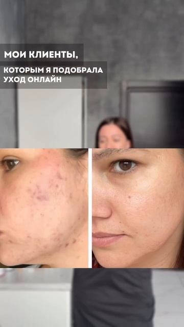 Подбор ухода за лицом ОНЛАЙН?  #ольгапетрунина #skincare  #кожалица #shorts