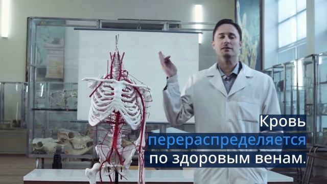 Почему варикозные вены надо удалять. Флеболог Москва.