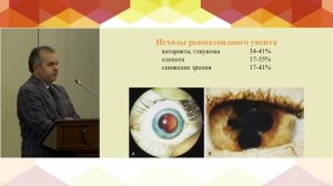 3. СЕССИЯ «ИЗБРАННЫЕ ВОПРОСЫ ДЕТСКОЙ ОФТАЛЬМОЛОГИИ»