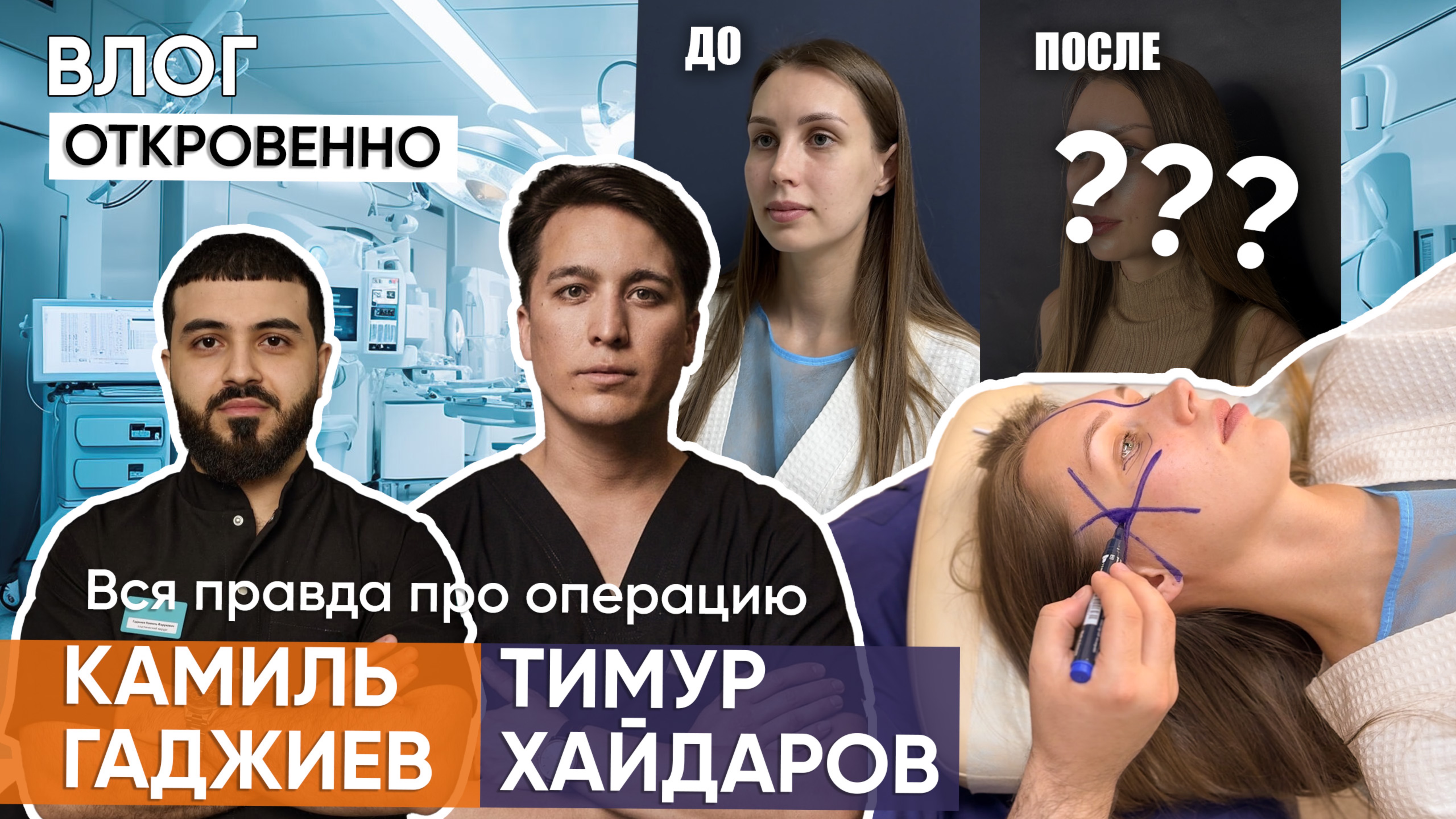 Моя операция у Камиля Гаджиева и Тимура Хайдарова / ВСЯ ПРАВДА про эндоскопическую подтяжку лица