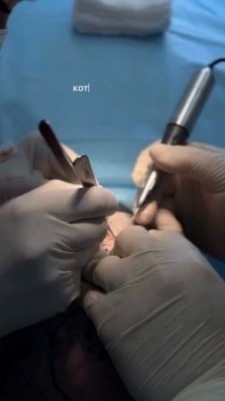 Сделали пересадку — подкрепите результат несложными действиями ✅