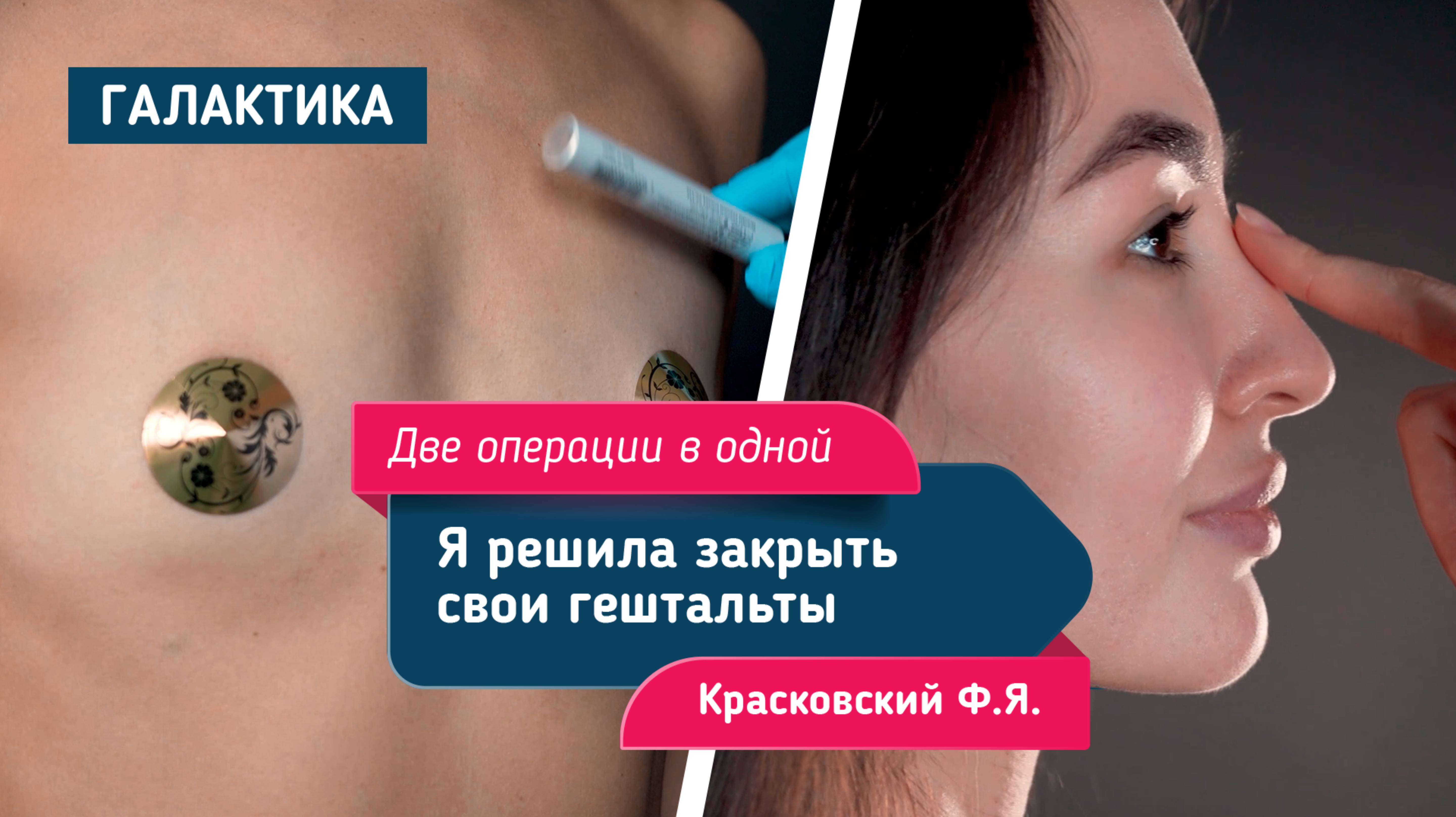 Повторная маммопластика и ринопластика после травм: история Азизы | Хирург Ф. Я. Красковский