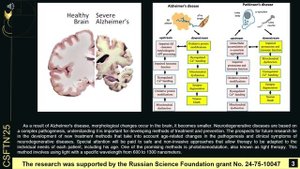 Age is a limiting factor for photobiomodulation of brain diseases. Nikita Navolokin