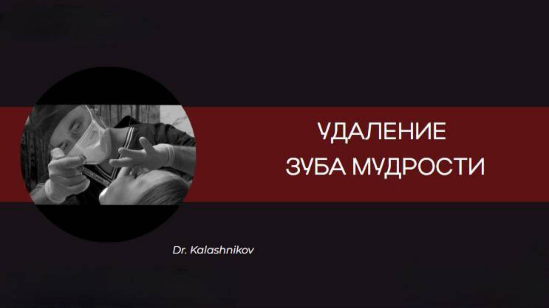 УДАЛЕНИЕ ЗУБА МУДРОСТИ смотреть онлайн