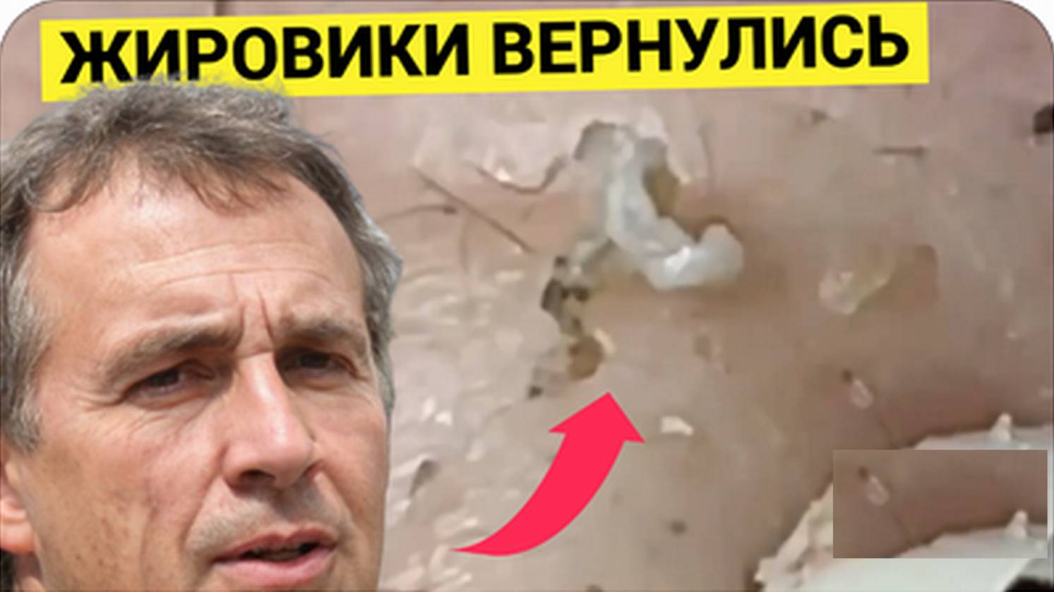 Продолжение Выдавливания СЛИВОЧНЫХ Жировиков, часть Вторая. Косметолог Устал, но Не Сломлен