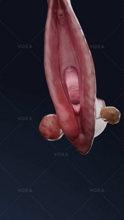 Что такое бартонилит и как он влияет на влагалищную область? Изучайте гинекологию в 3D с VOKA