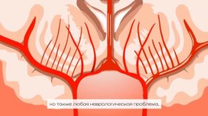 Отделение неотложной неврологии