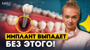 КОСТНАЯ ПЛАСТИКА перед имплантом - когда без неё НЕЛЬЗЯ?
