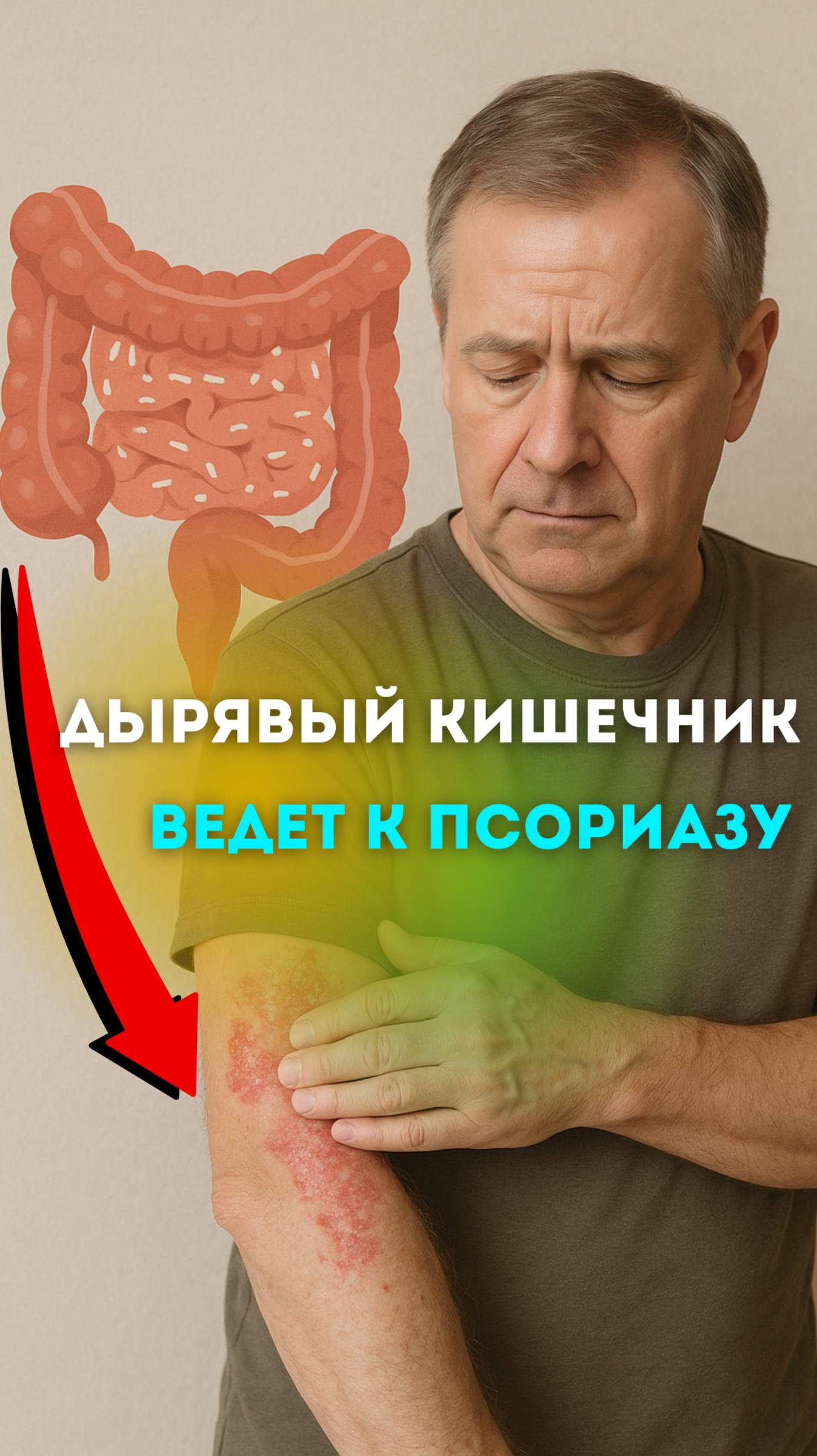 Причина псориаза - дырявый кишечник