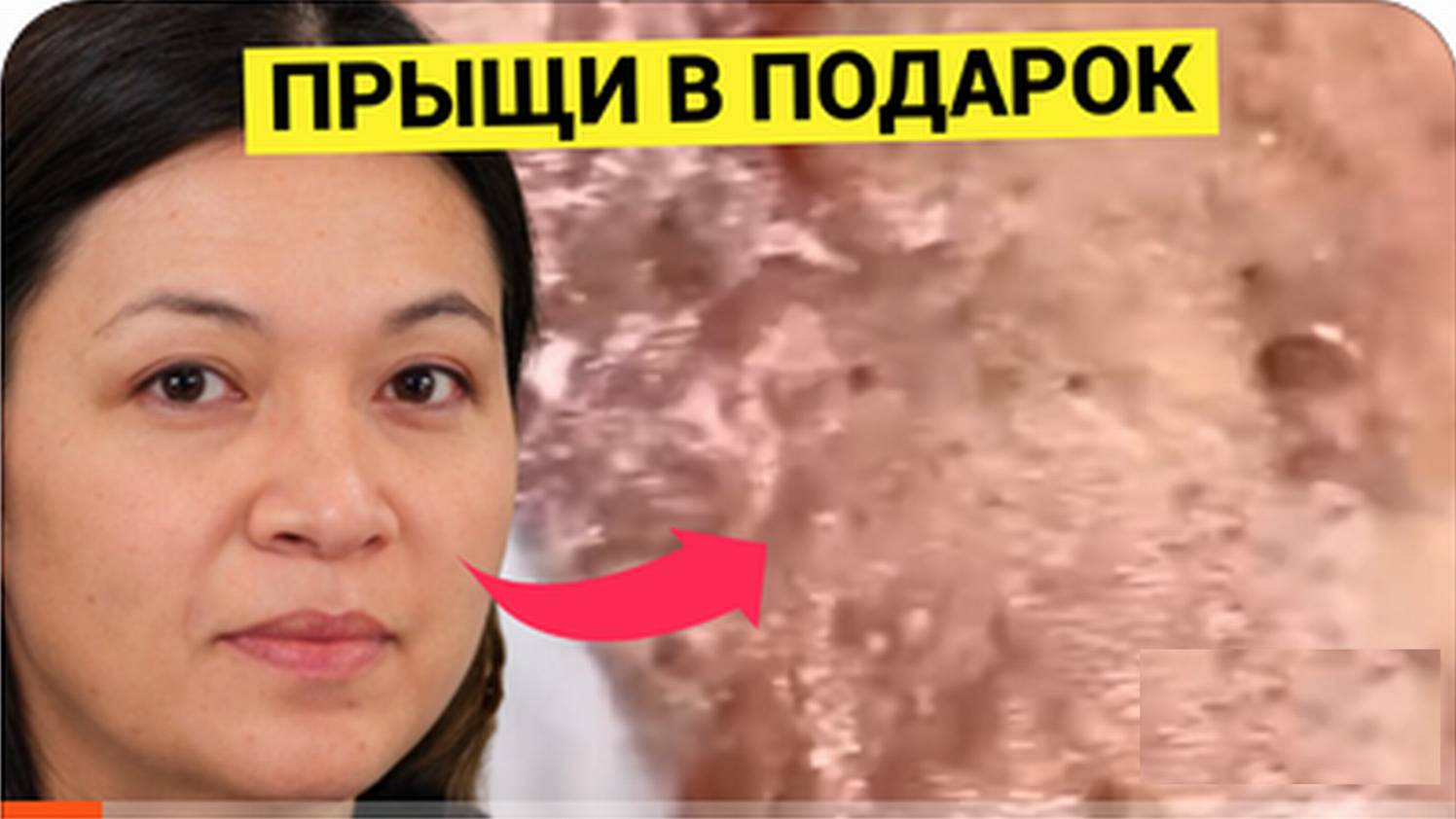 ПРЫЩИ на День Рождения Мастера. Лучшие Жировики в Подарок