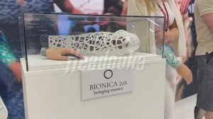 На ПМЭФ представили биопротезы, разработанные с помощью ИИ