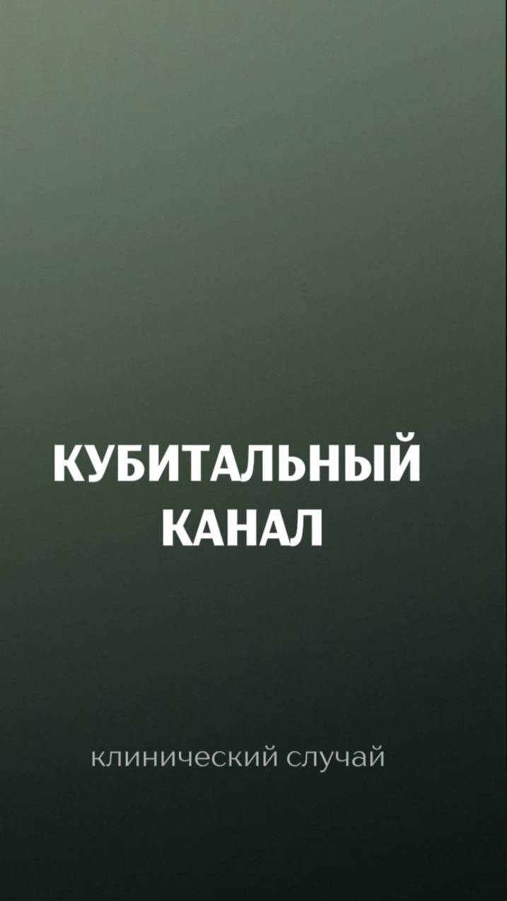 Интересный случай на приеме у невролога