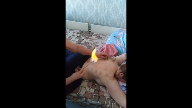 Банки на спину смотреть онлайн