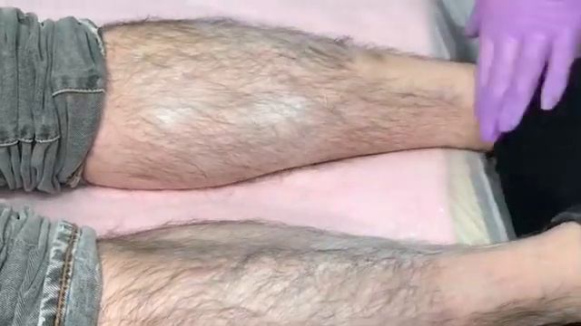 Мужская эпиляция ног