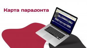 Карта парадонта в D4W