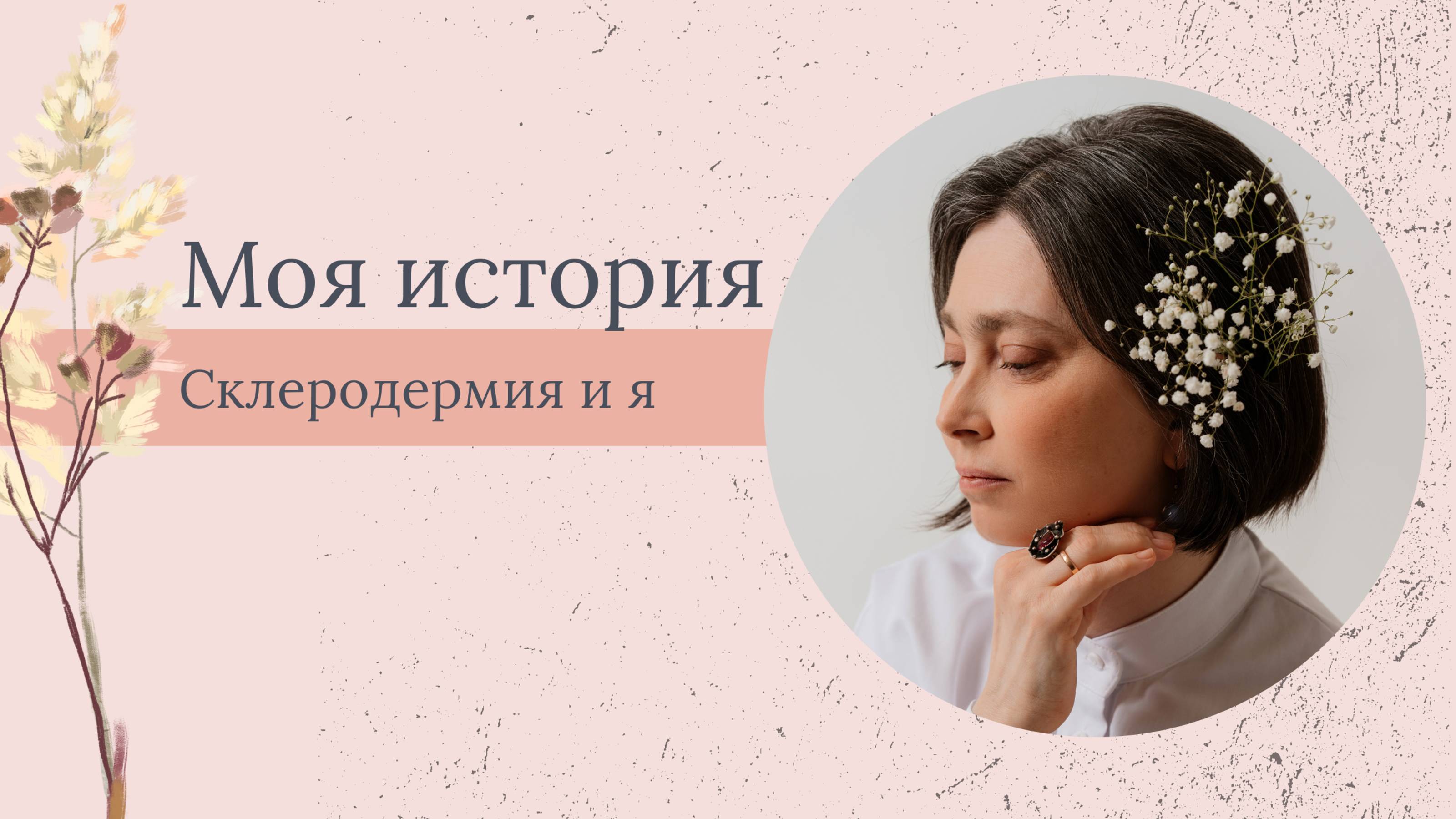 Интервью с Марией про склеродермию
