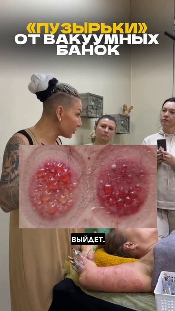 Что происходит с лимфой, когда человек долго лежит и мало двигается❓