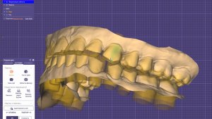 Цифровая модель будущих зубов