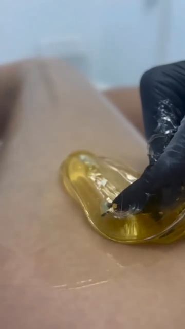 Полимерный воск в Epil Story #лазернаяэпиляция #депиляция #электроэпиляция #косметология смотреть онлайн