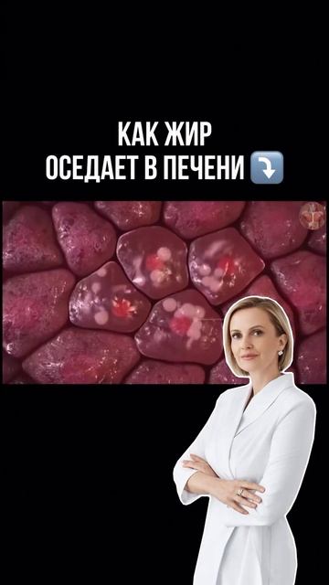 Как жир оседает в печени?