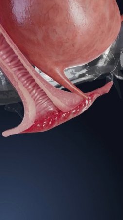 Что такое вульвит и как он влияет на здоровье женщин? Объяснение в 3D