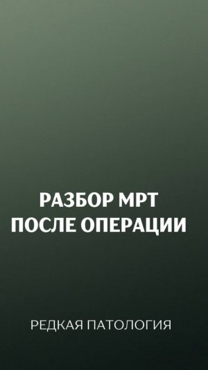 Разбор МРТ после операции