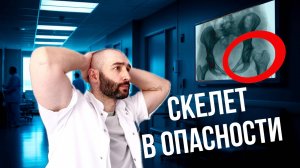 Это может коснуться КАЖДОГО! Остеопороз - болезнь хрупких костей