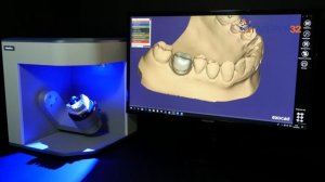 Протезирование диоксидом циркония на индивидуальном абатменте