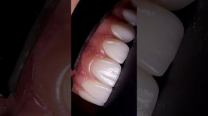 Как приятно делать людей не только здоровыми, но еще и красивыми!!!
