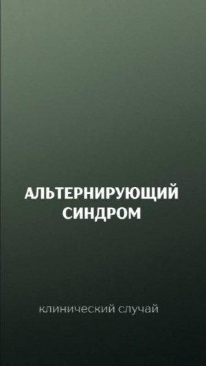 Альтернирующий синдром. Клинический случай