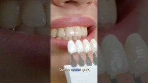Отбеливание зубов — самая бесполезная процедура? #стоматология, #отбеливаниезубов, #виниры