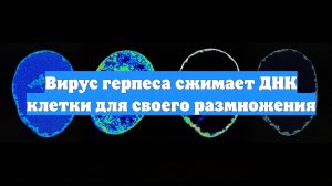 Вирус герпеса сжимает ДНК клетки для своего размножения