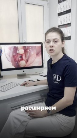 Всё про имплантацию зубов за 1 минуту на прмере клинического случая