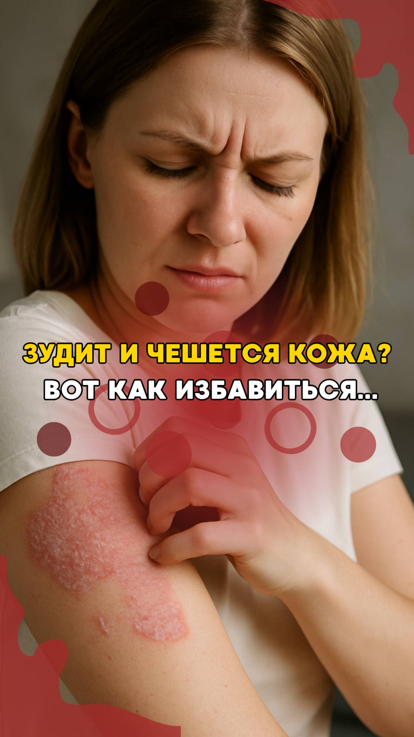 Кожа краснеет, шелушится, чешется и зудит?