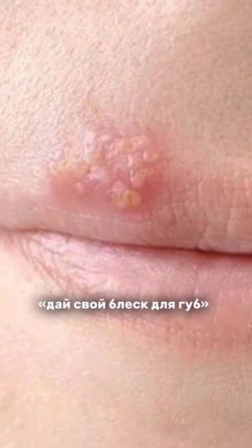 Выиграйте продукт RClinic в еженедельном розыгрыше в tg канале 🎁 #косметикадляухода #лечениеакне