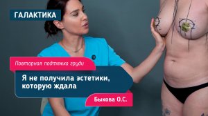 Повторная маммопластика: птоз, замена имплантов Motiva на Mentor | Хирург Быкова