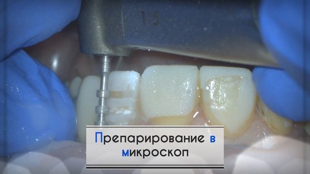 Некоторые пациенты особенные
