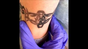 Осветление тату под кавер-ап