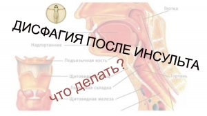 Дисфагия и голосовые связки