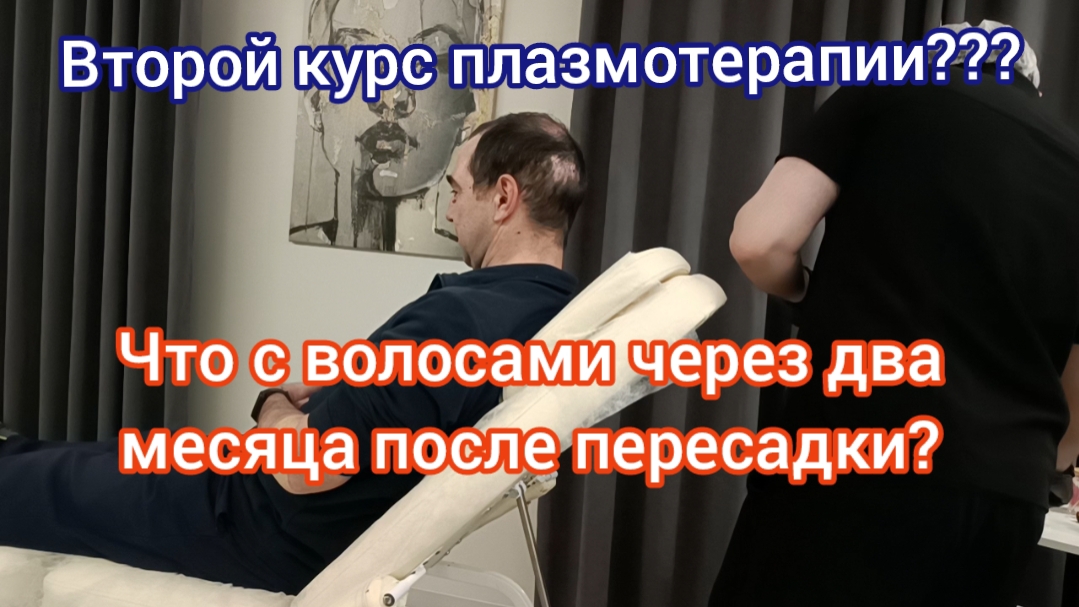 Пересадка волос. Два месяца после пересадки. Второй курс плазмотерапии.