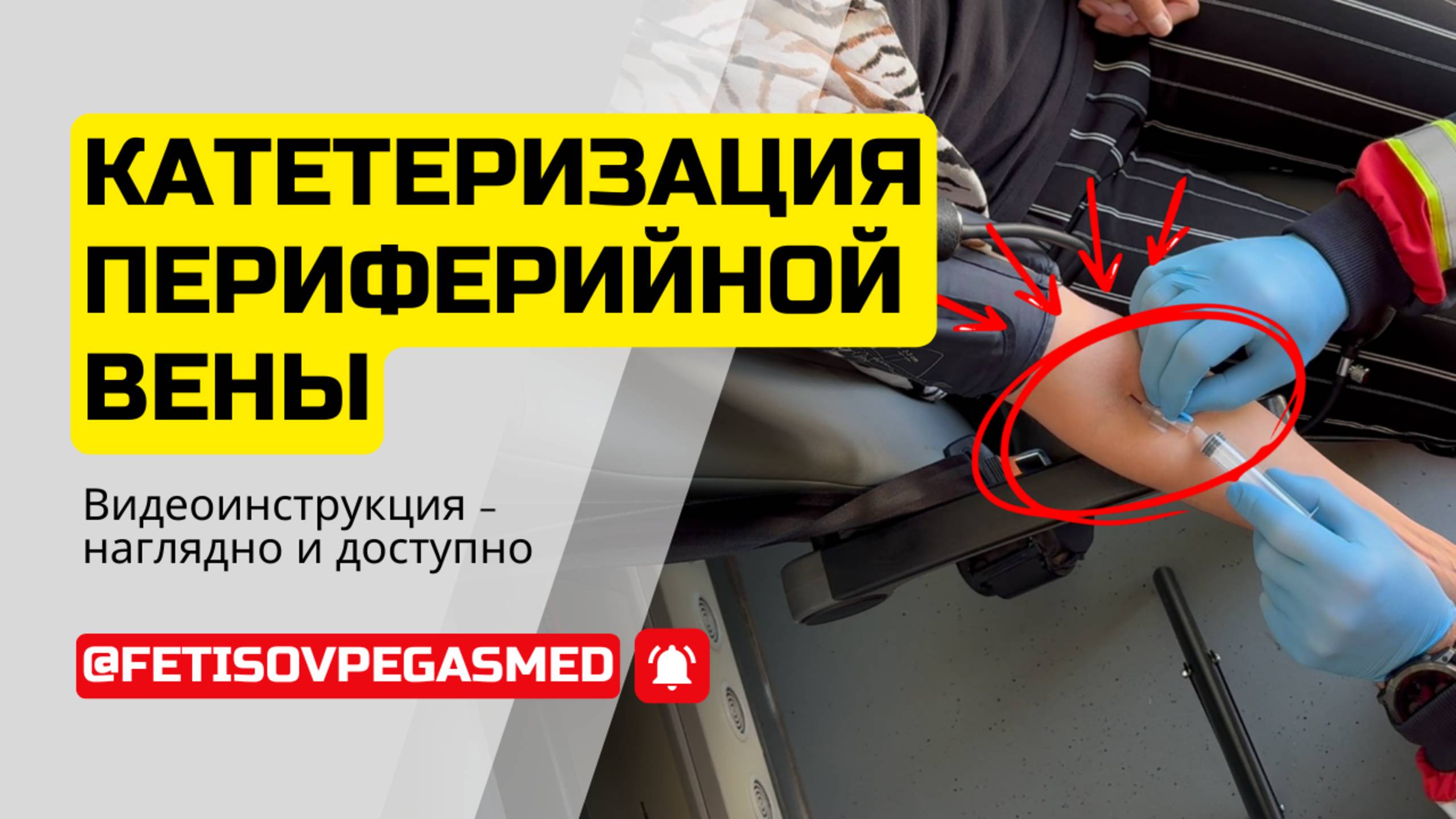 🔍💉Катетеризация периферических вен: техника поиска и пунктирования