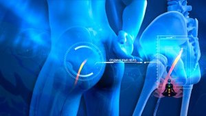 МАТРИЦЫ-ГАРЯЕВА.РФ АРХИВ: Официальный сайт Архив Матриц Гаряева: Гаряев-Матрицы.рф Матрица №7 Ишиас