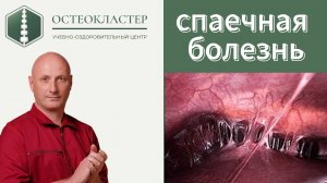 Спаечная болезнь.