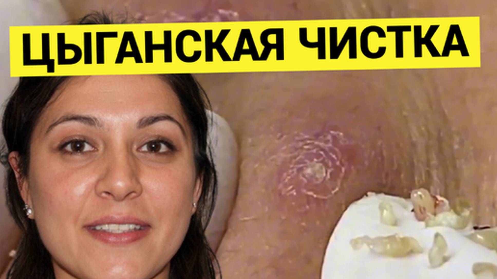 Халтурная Чистка Лица _На Отвали_