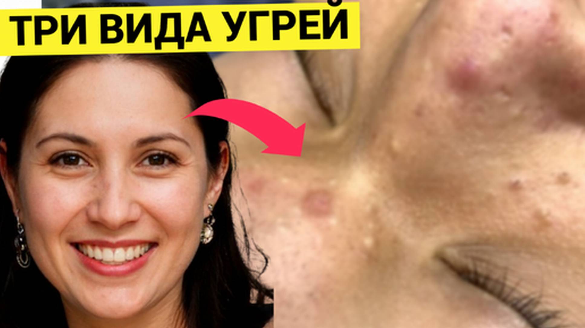 Яркий набор Комедонов и Угрей предложил Выдавить Дядя Косметологу. Специалист принял вызов достойно,