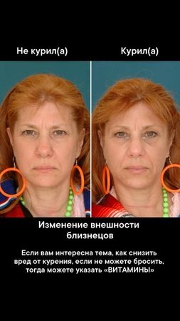 Изменение внешности близнецов из-за кurenia