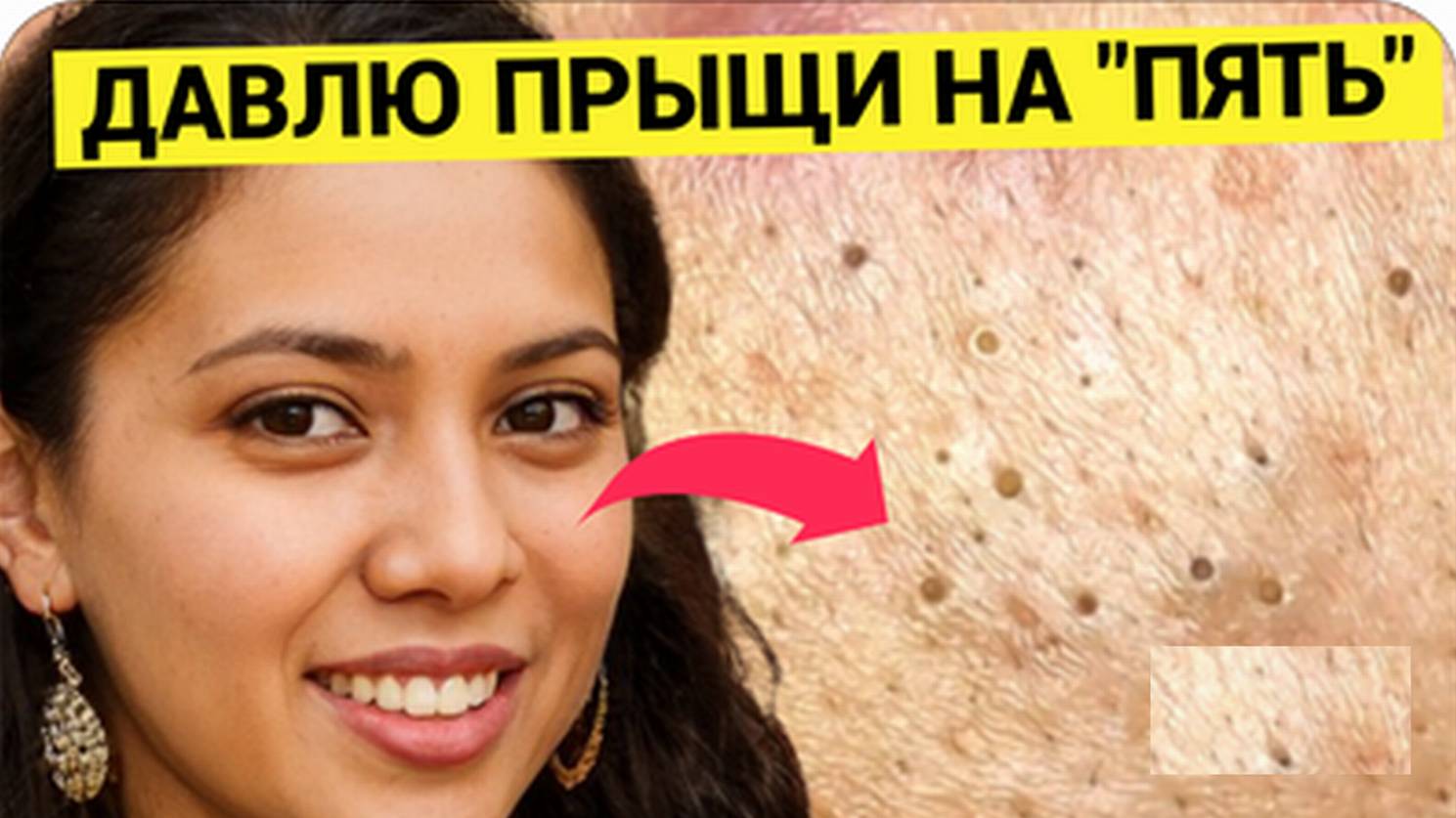 Давит Прыщи и Жировики Косметолог с Синдромом Отличницы. Очень старательная мастер и _богатый_ на Уг