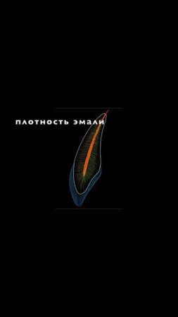 Ударные волны вызывающие клиновидные дефекты. Схема из фильма #стоматология #shorts