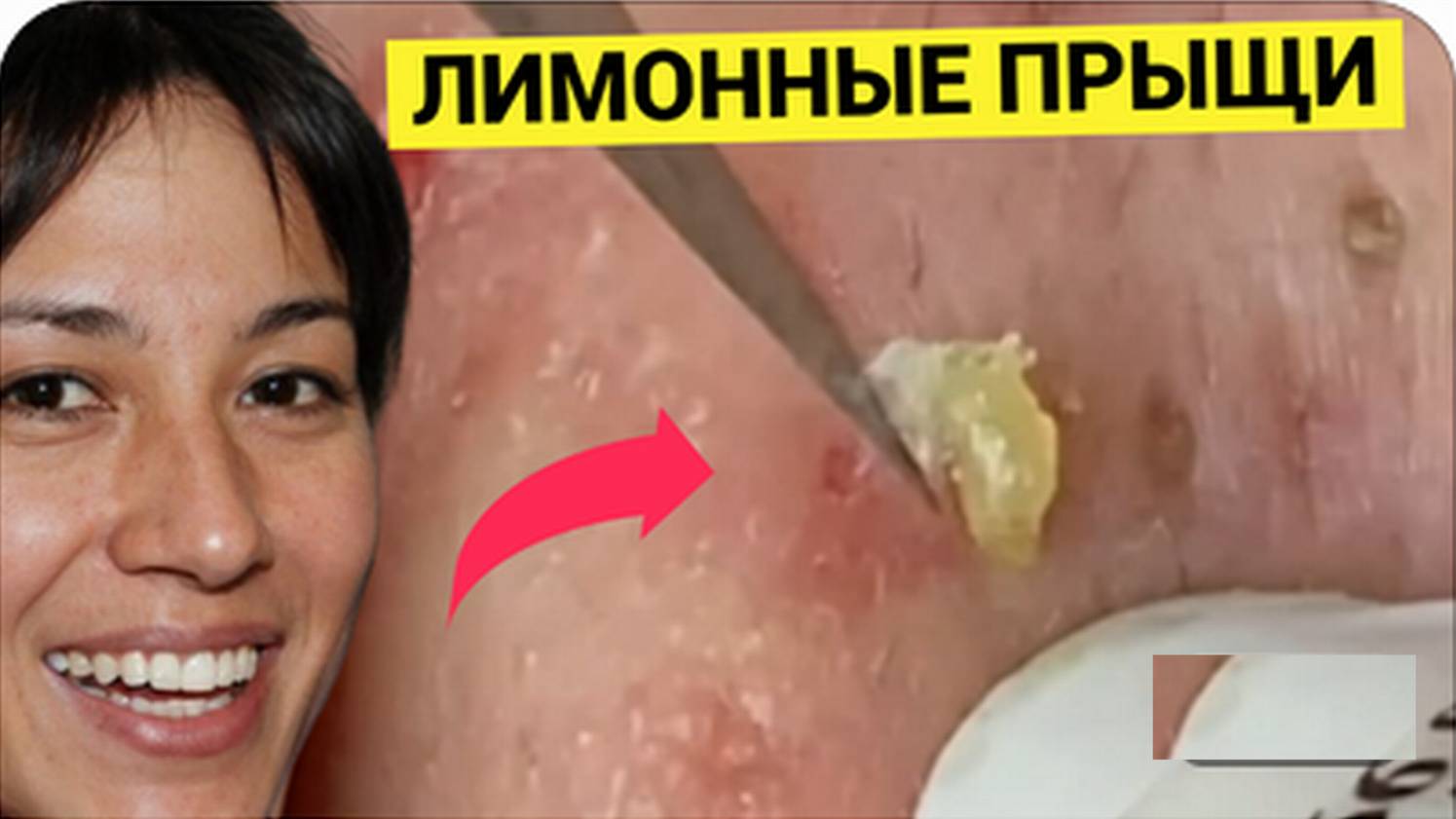 Угри и Жировики в ЛИМОННОЙ Футболке пришли к Косметологу, а тот оказался Недобросовестным Халтурщико