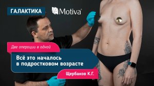 Тубулярная грудь: коррекция и увеличение груди с имплантами Motiva | Хирург Щербаков К.Г.
